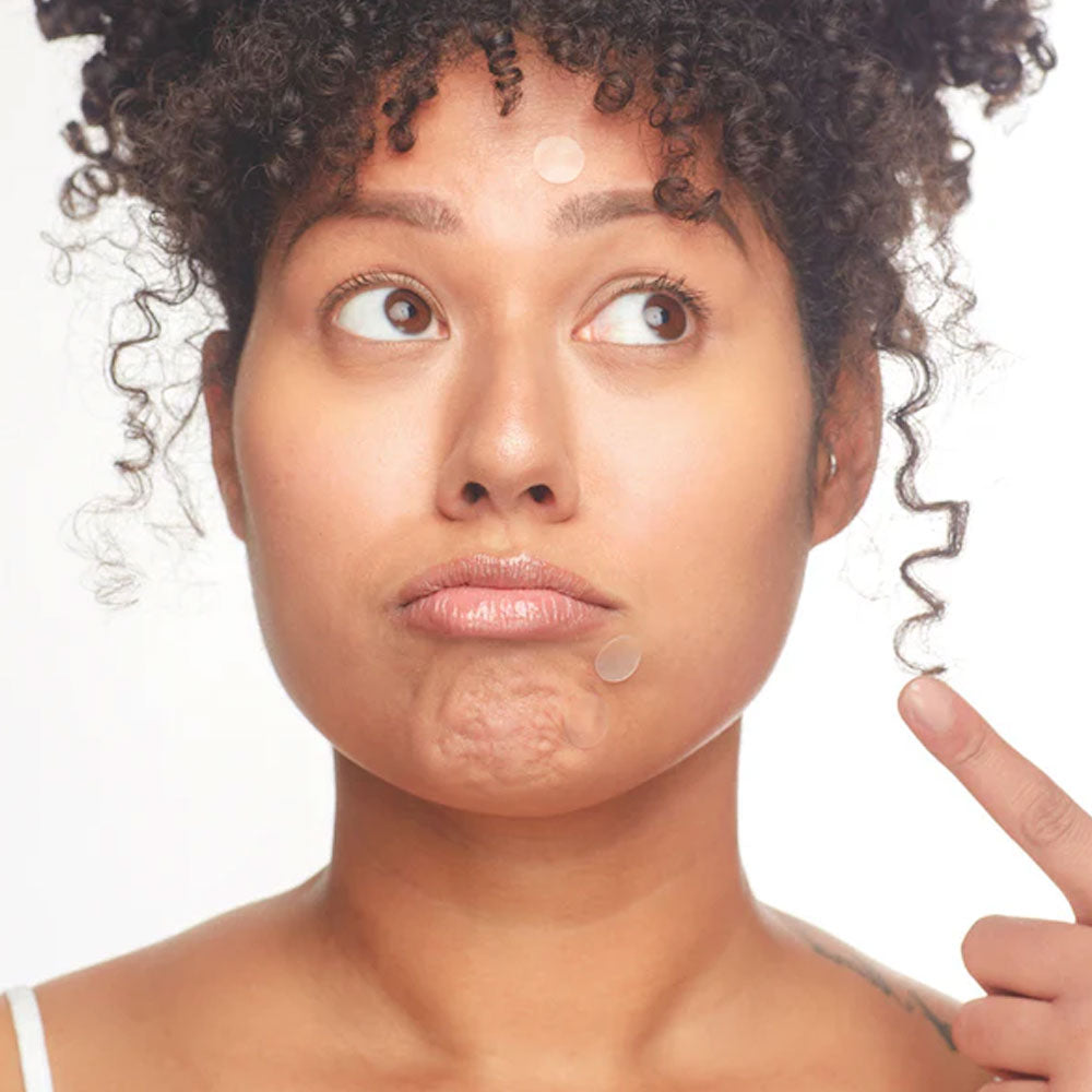 Breakout Box Acne Treatment